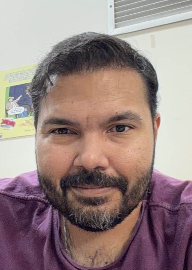 Depois do transplante capilar — cobertura recuperada